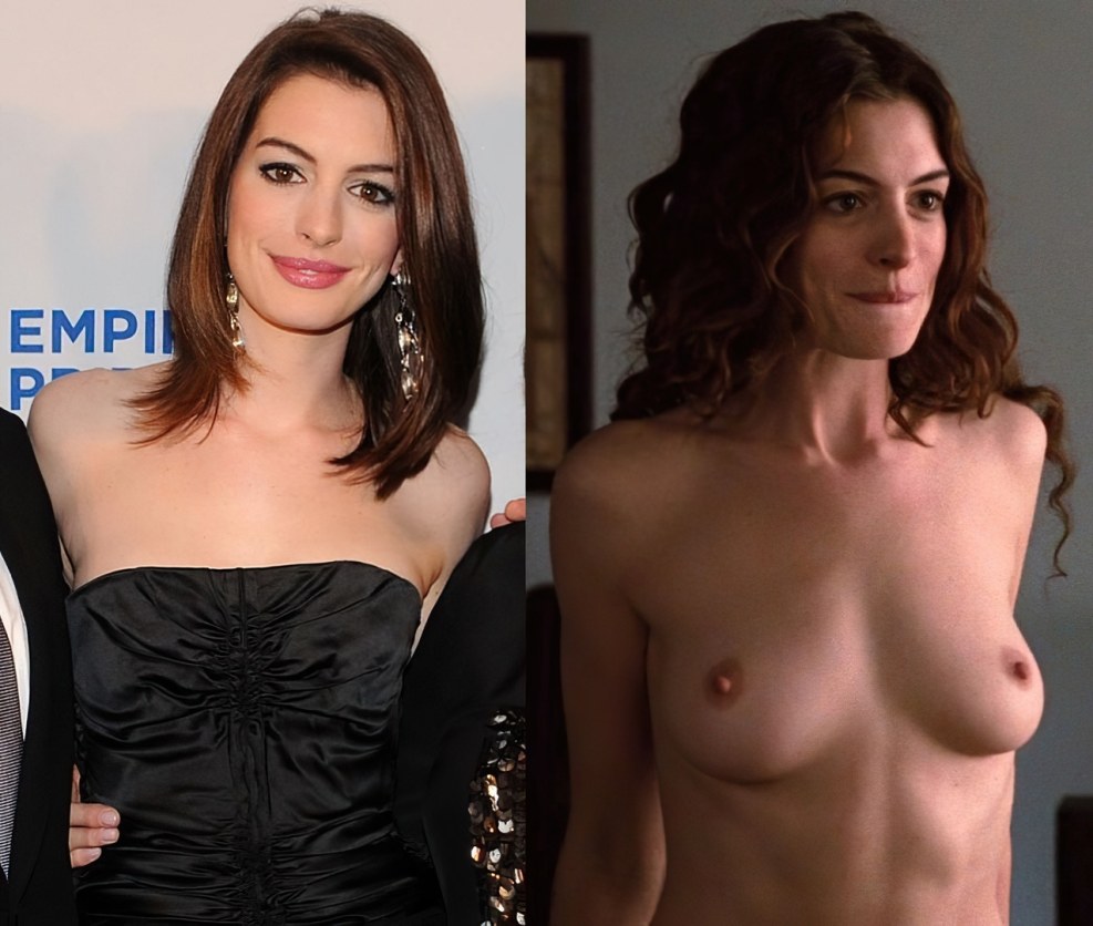 Anne Hathaway is frank