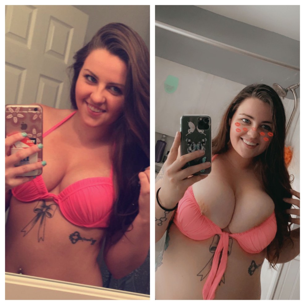 Fat Belly Girl Before After with tits