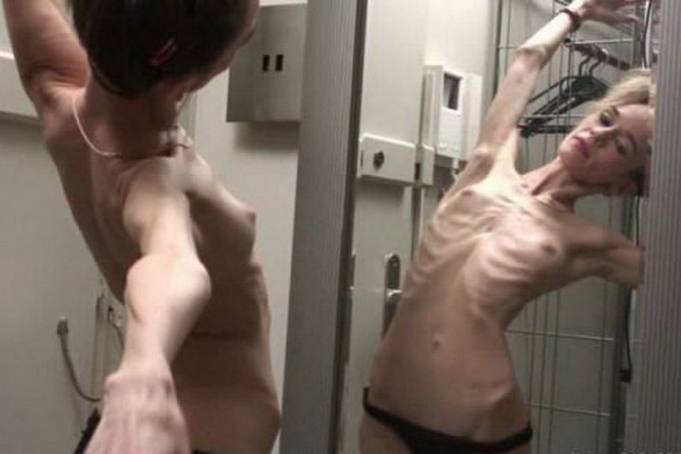 Naked men with anorexia