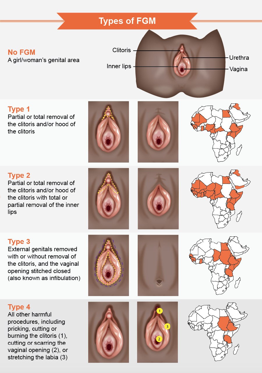 Female circumcision porn