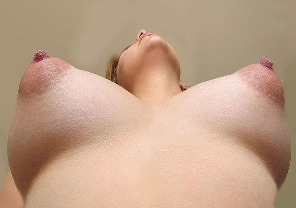 Large excited nipples
