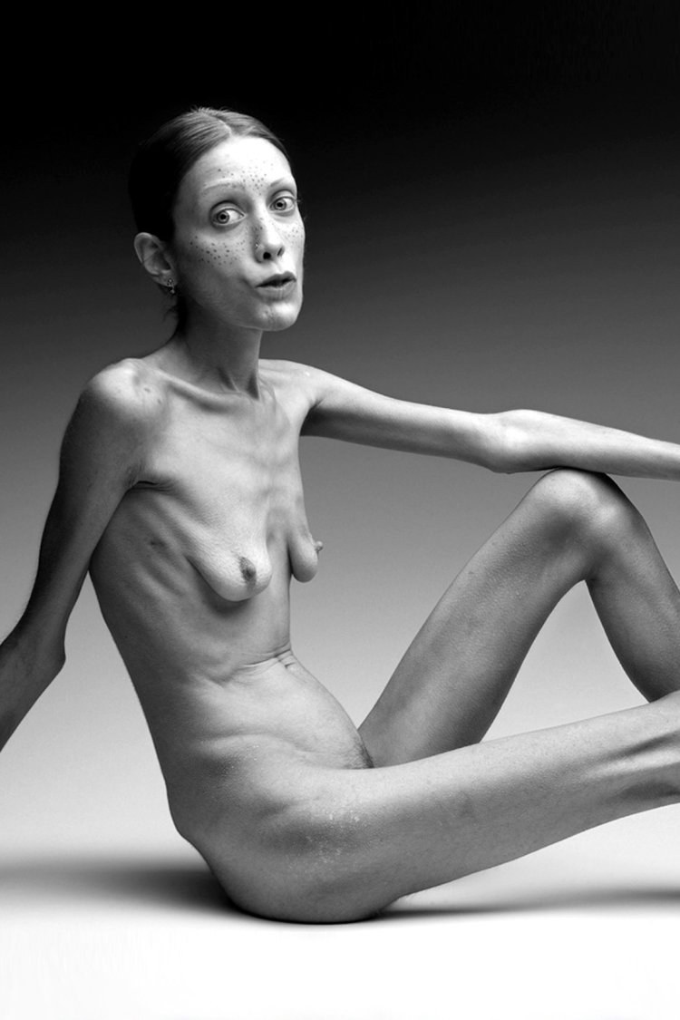 Anorexic girl XXX