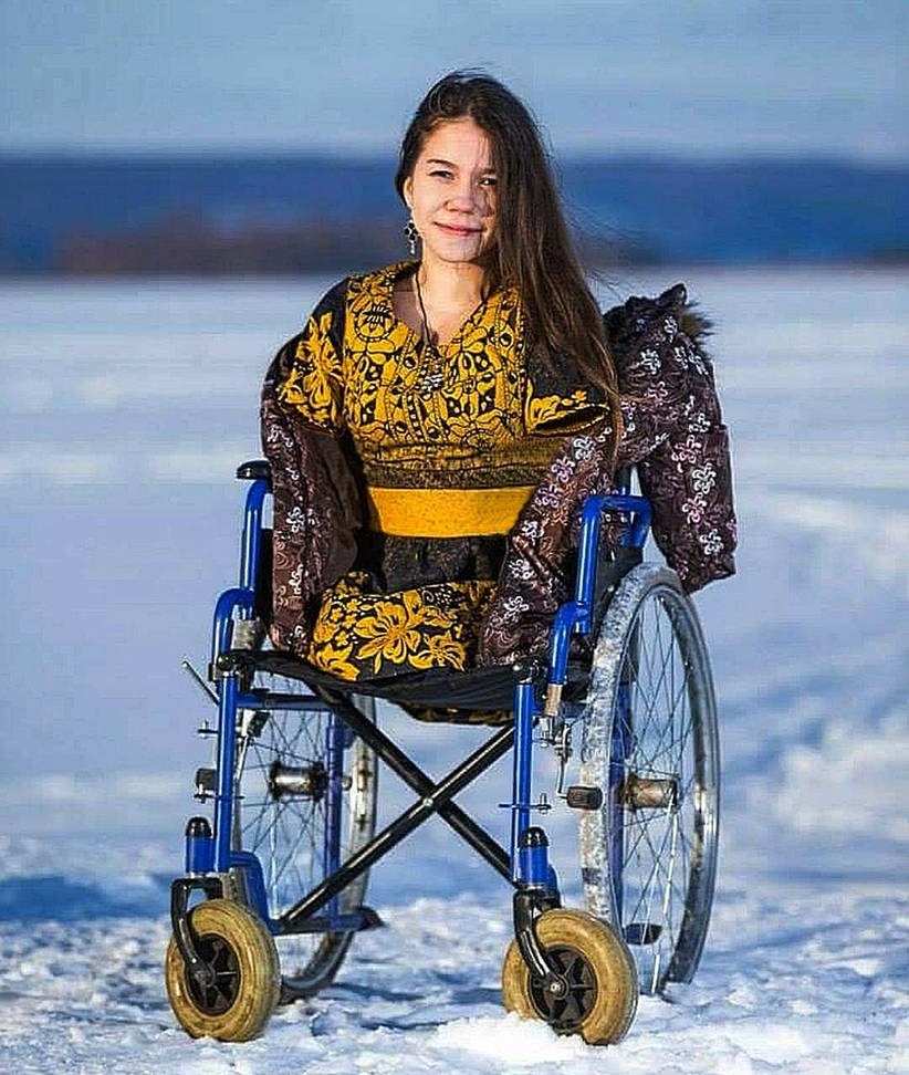 Amputee fantasy (61 photos)