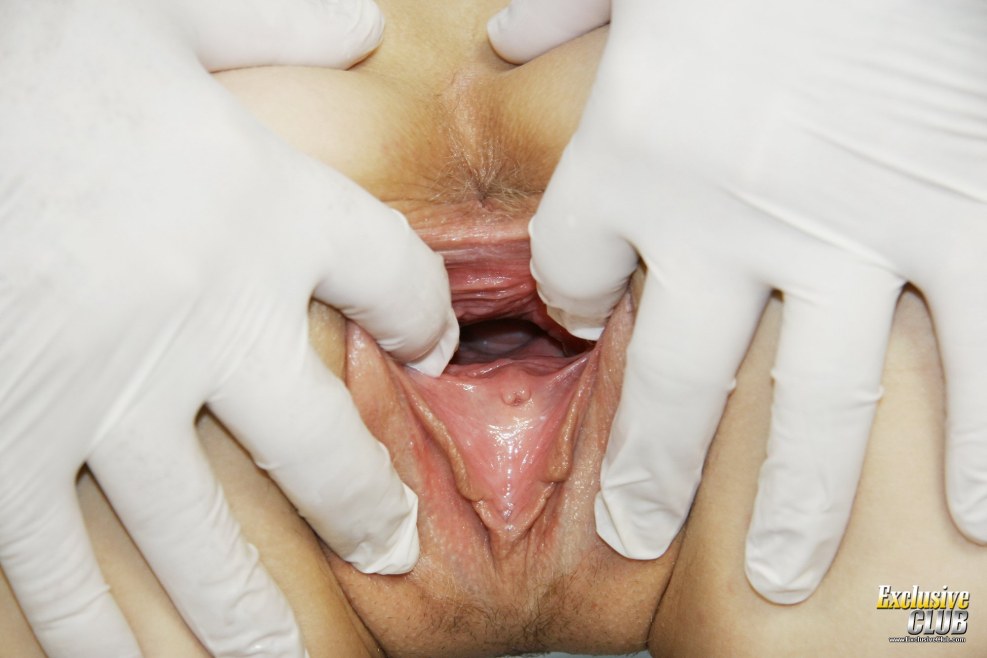 Pornovideo Lesbian gynecologist