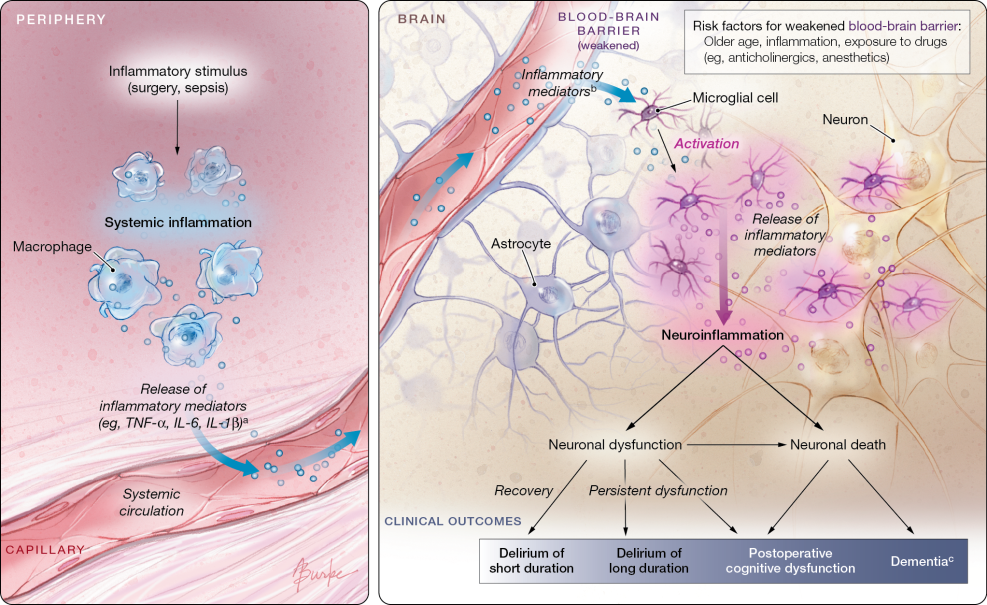 Postoperation Cognitive Dysfunction
