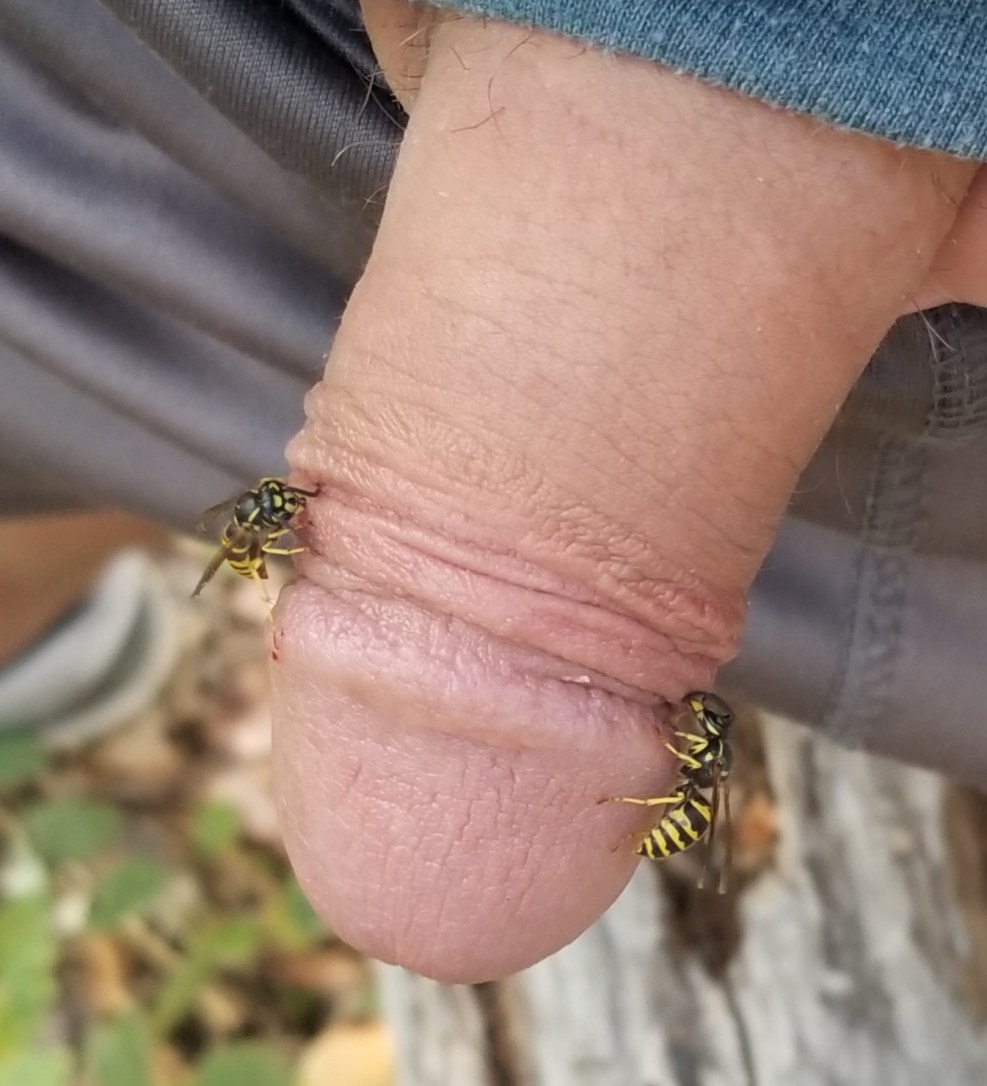 Insects bite nipples