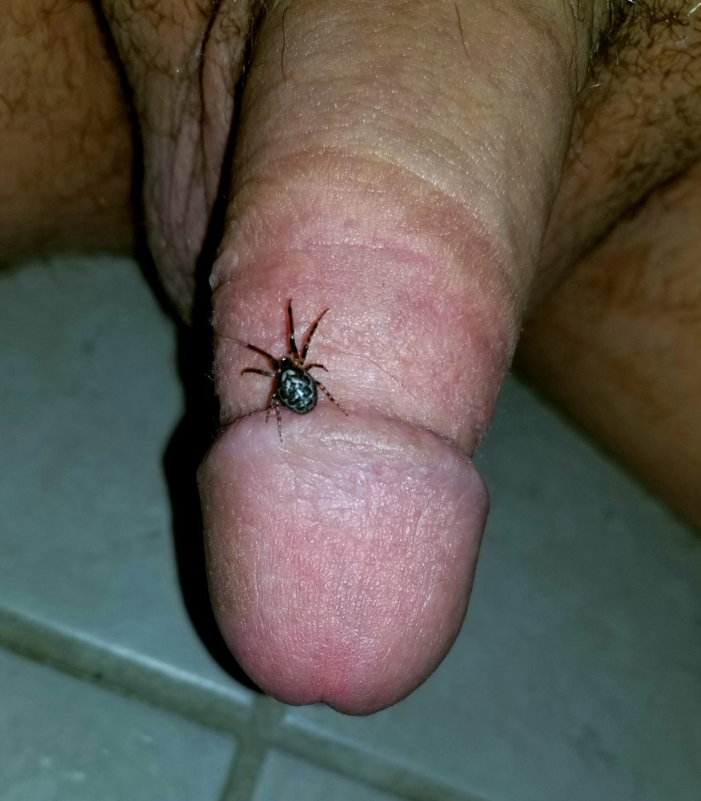 Insect on women's nipple