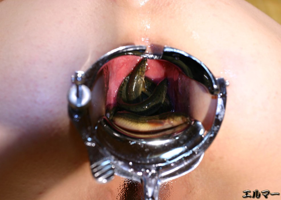 Insects in vagina girls