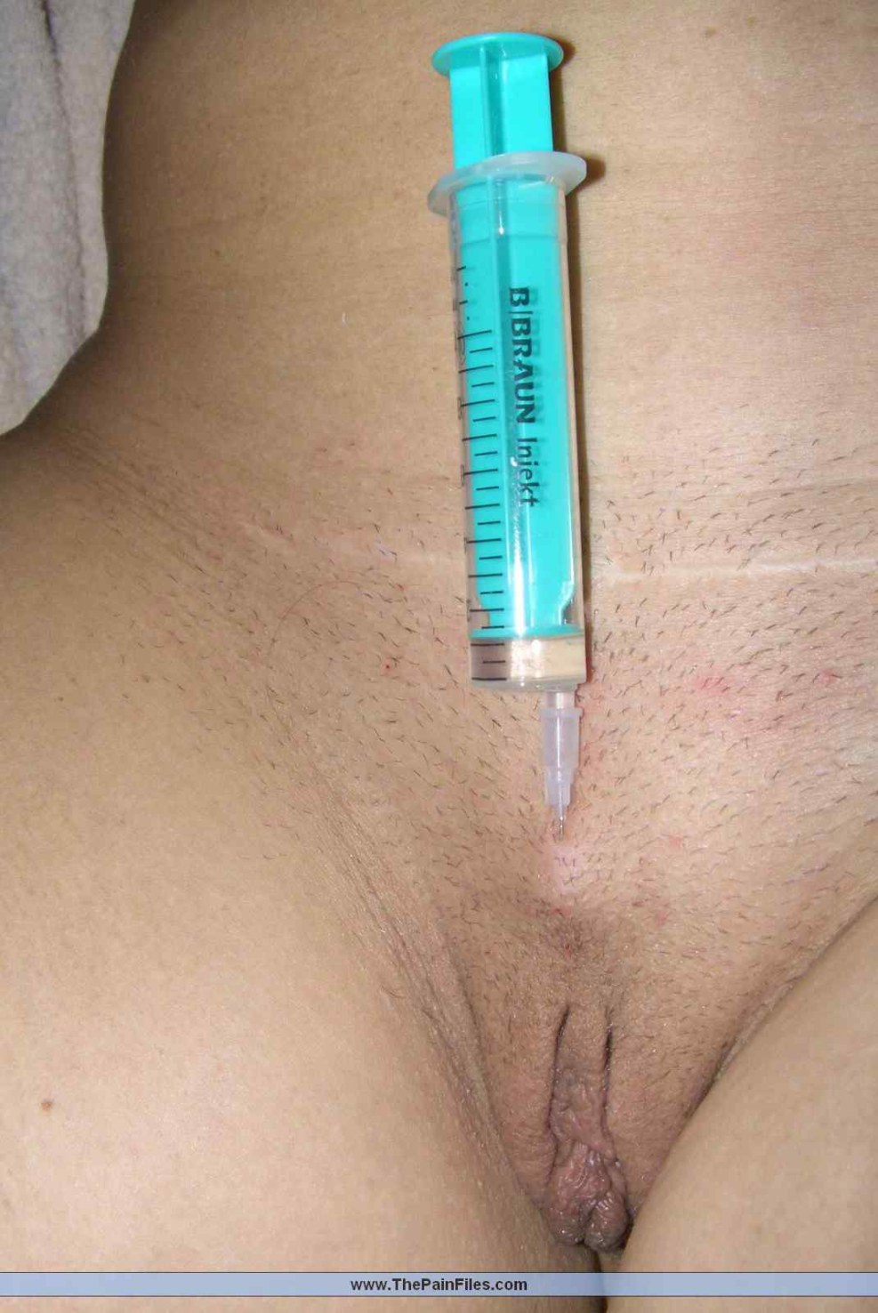 Injection with Syringe Full of Seperm Into Uterine Cavity