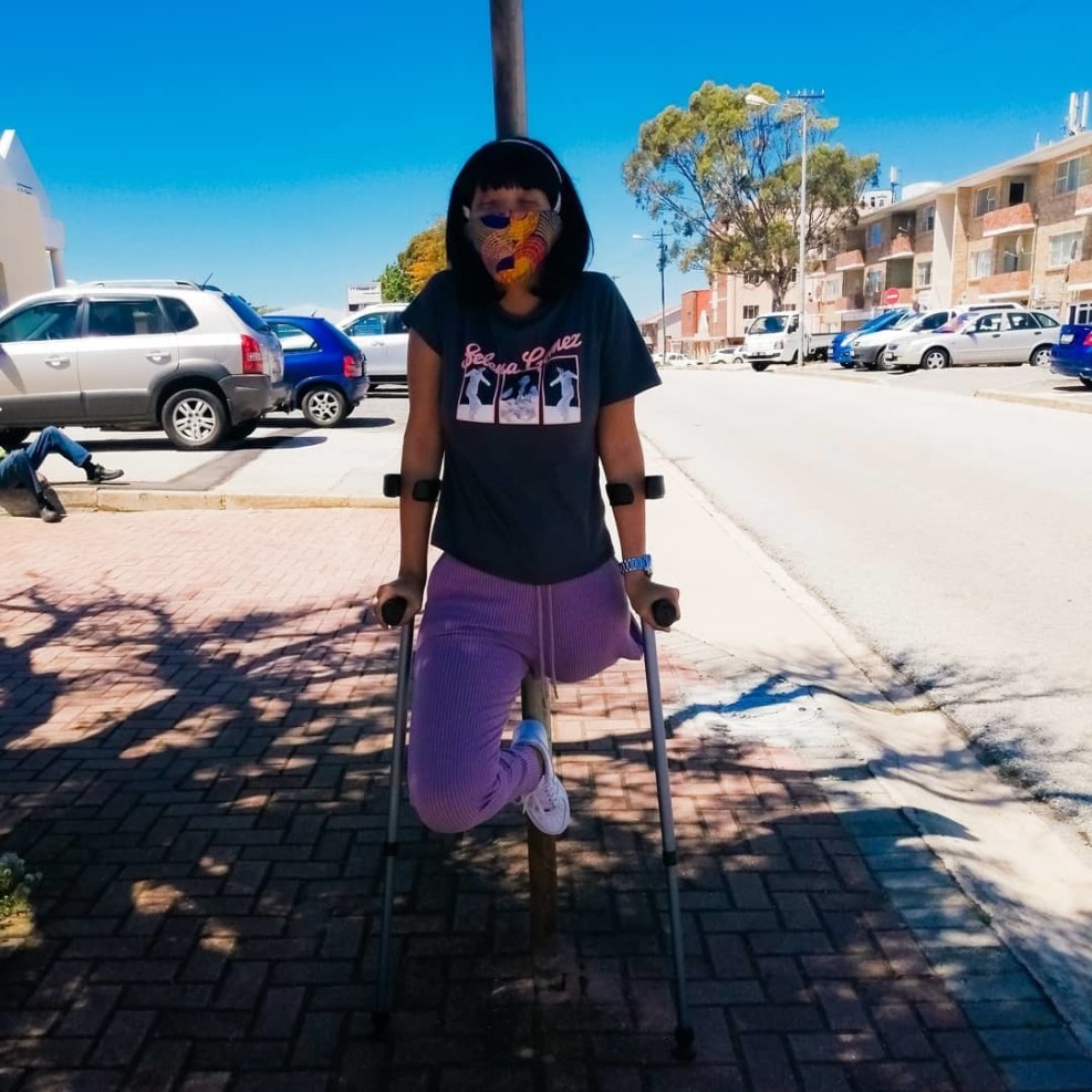 Elizabeth Tkachenko amputa