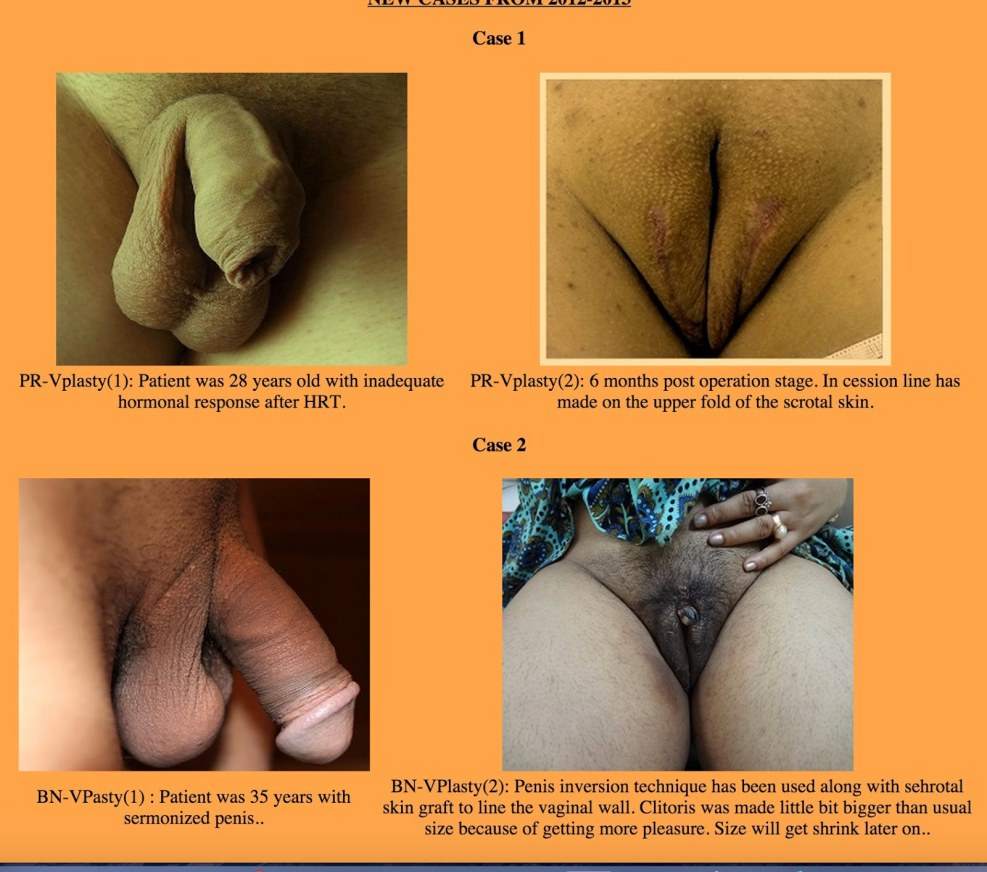 Genitals of men and women