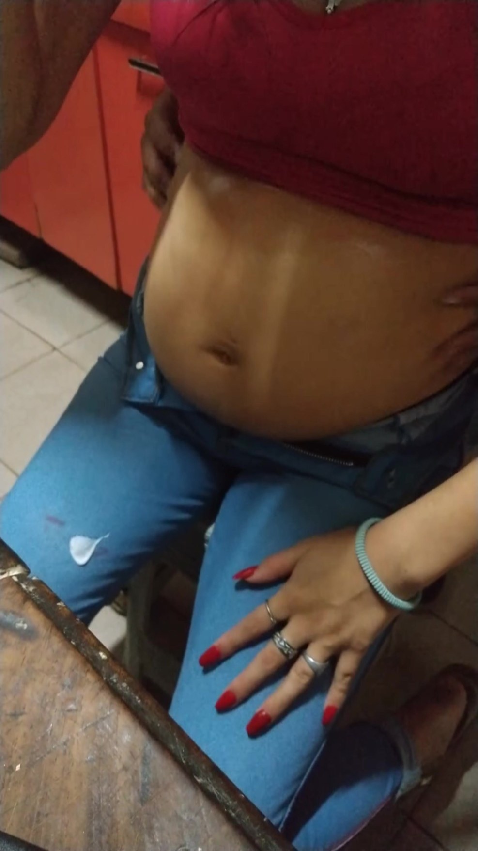 Girl with tummy Fiderism