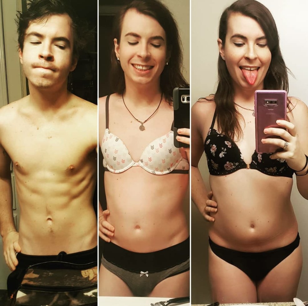 Transgender girl MTF