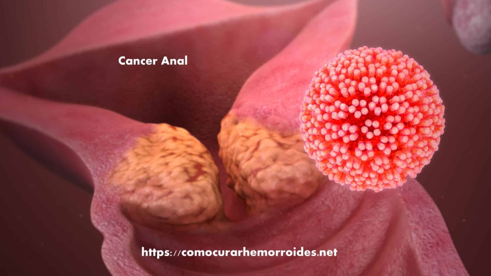 Tory Lux Mike Adriano