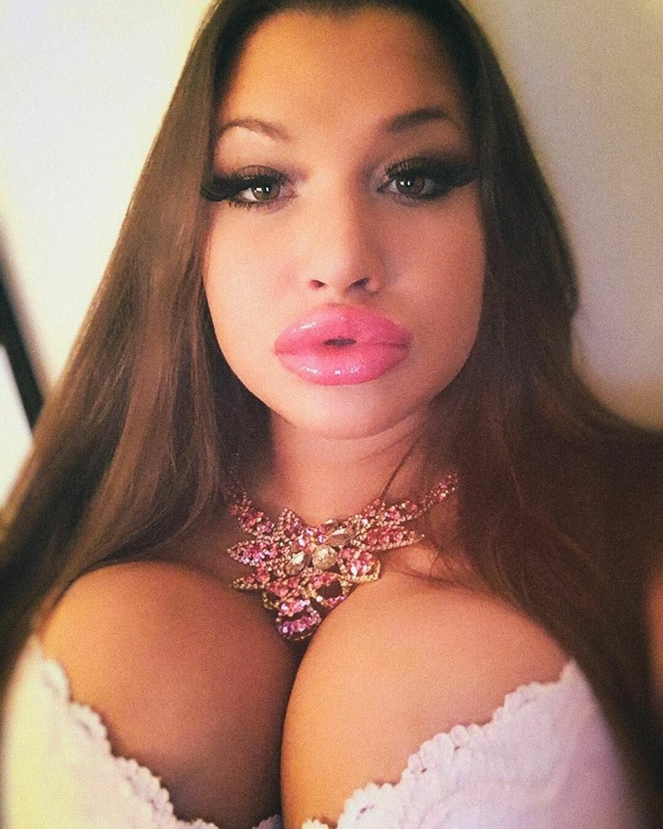 Bimbo lips