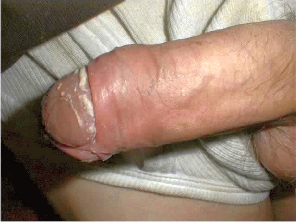 Member Cums close -up